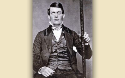 The Strange Case of Phineas Gage